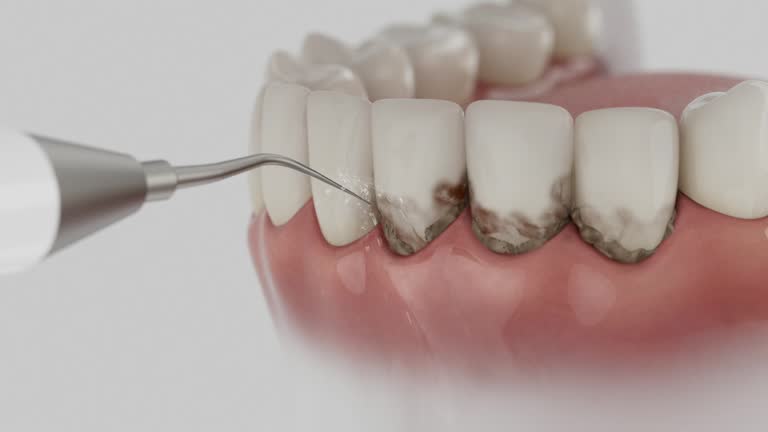 Reliable Teeth Whitening contractor in St. Elmo, IL by Smile Center Dentistry
